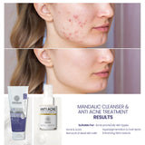 Mandalic Cleanser & Anti Acne Treatment